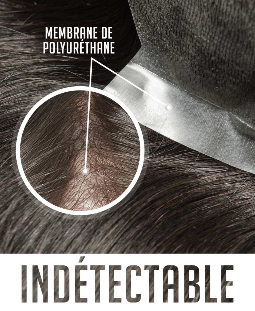 fiche_toupet_kuro_indetectable complément capillaire solution calvitie homme jeune