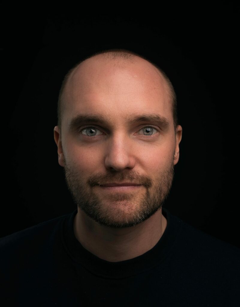 hair-loss-scaled.jpg perte de cheveux solution alopecie calvitie homme complement capillaire