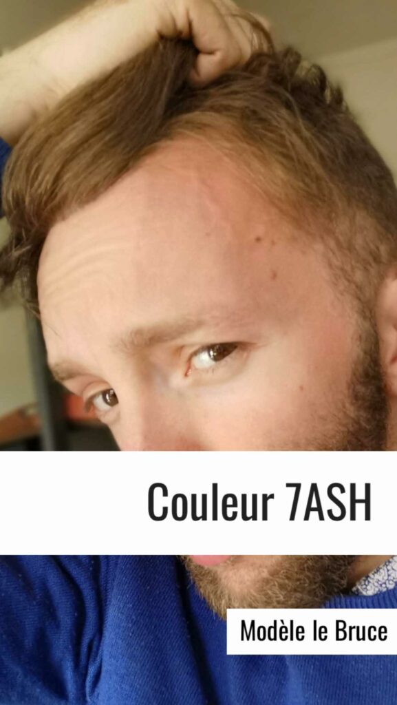 prothèse capillaire homme 1B50